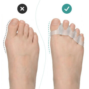 Alternative view of OrthoRelax® – Διαχωριστικό Δακτύλων σε Gel (2 διαχωριστικά)